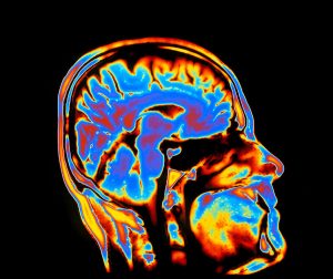 brightly lit scan of brain & head
